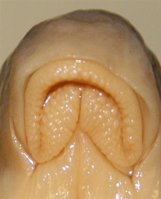 No 1 Tca Wart Removal Kit Today