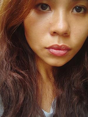 Best Mole Removal Tips In Hindi Now