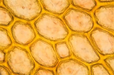 Best Can I Use Normal Wart Remover On Genital Warts Now