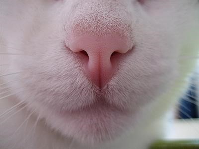 Top Skin Tag Removal On Eyelids Near You