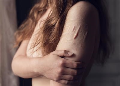 Latest on Mole Removal Doctor In Chicago Today