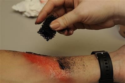 Best Best Skin Tag Removal System Fast