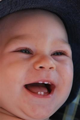 Choice Skin Tag Removal Methods
